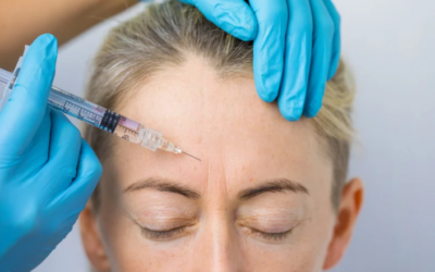 Botox resistance