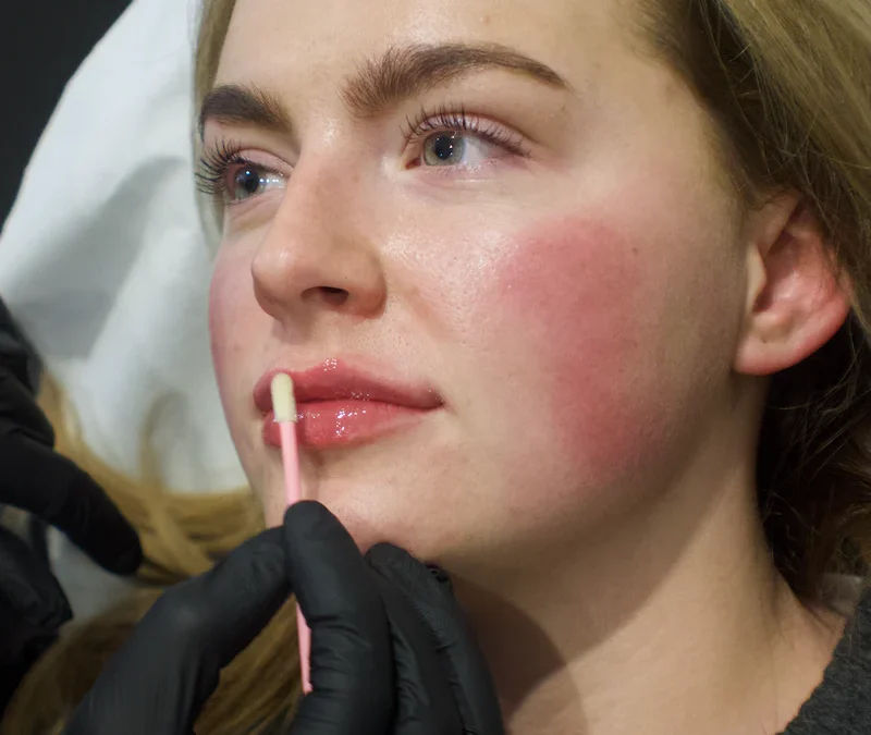 The Importance of Post Injectable Aftercare: Are You Using Insurable Products?